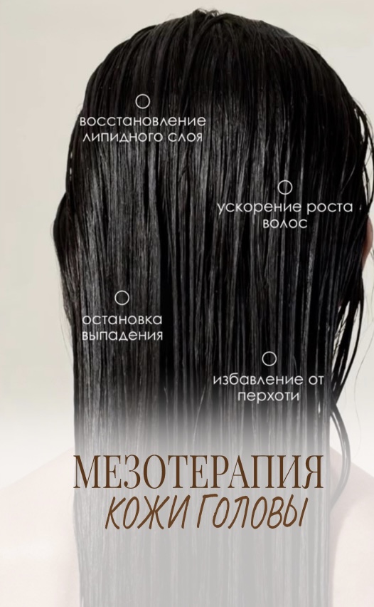 Мезотерапия головы