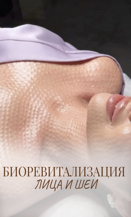 Биоревитализация